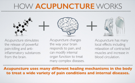 New York City Acupuncture Physical Therapy & SusTus Chiropractic